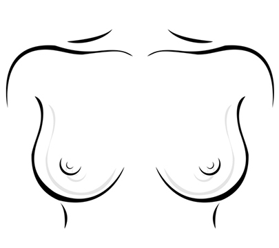 breast surgery after